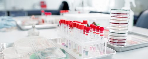 Test tubes with Petri dishes on the table in bacteriological department of laboratory