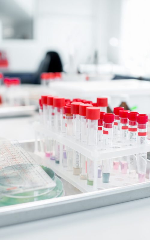 Test tubes with Petri dishes on the table in bacteriological department of laboratory